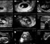 بررسی رشد جنین سونوگرافی دوران بارداری است که کاربردهای زیادی دارد که اصلی‌ترین آن بررسی رشد و تکامل جنین است.